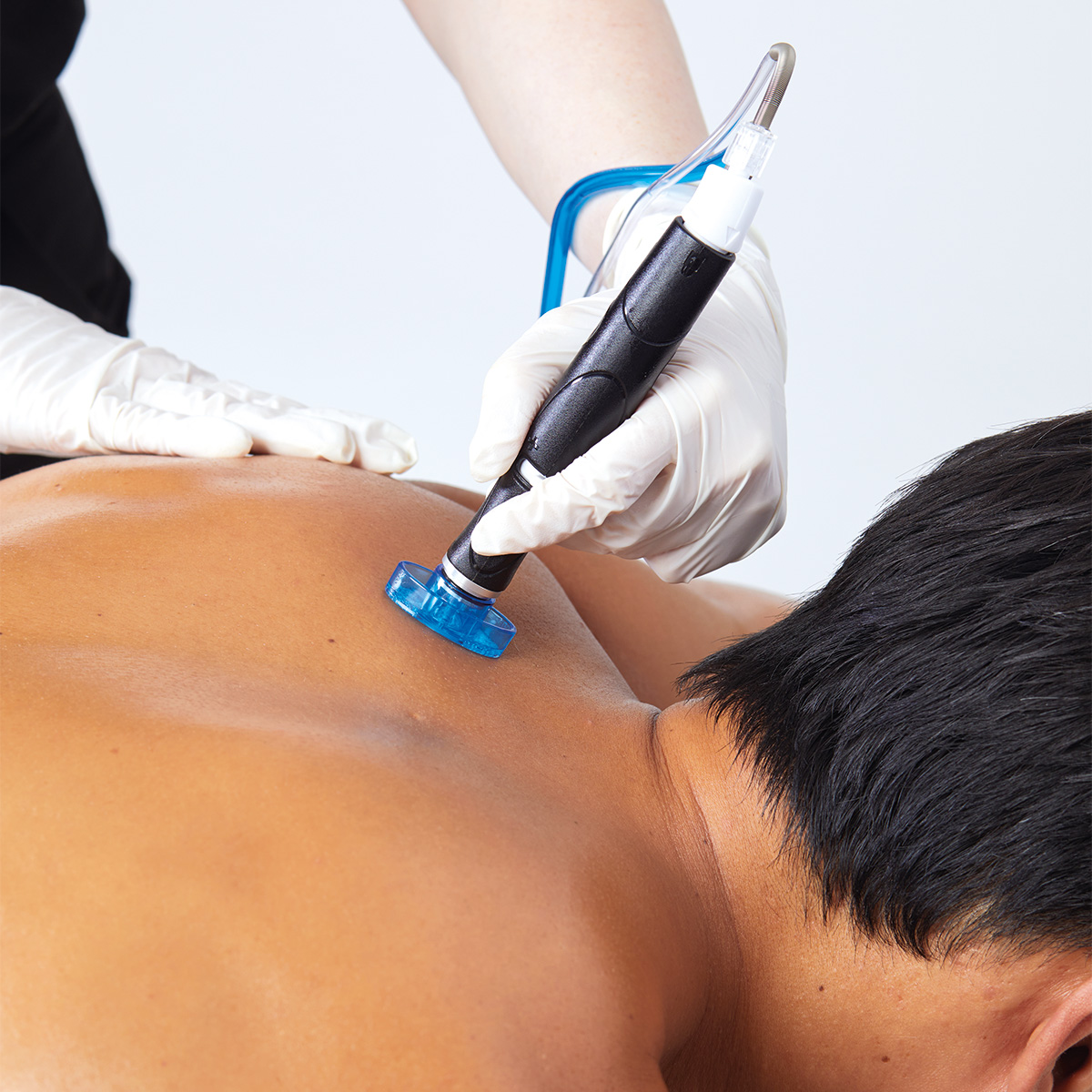 Hydrafacial se décline sur le corps avec Hydra Body